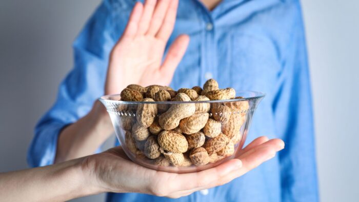 Alergias alimentarias